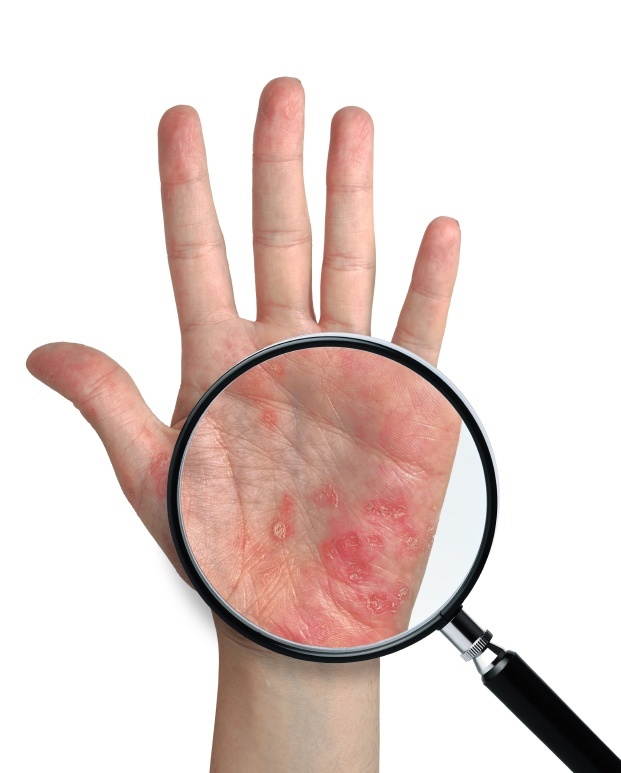 Trust fined for exposing workers to dermatitis risk